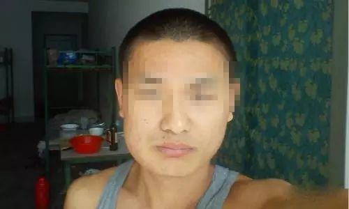 小伙嚼檳榔八年，習(xí)慣背后的臉型巨變，習(xí)慣與后果的警示故事