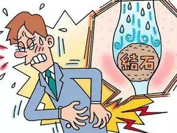 飲水量對預防結石的積極影響