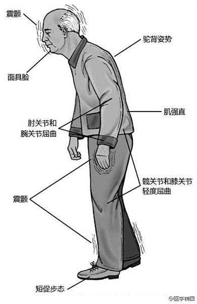 增強脊柱靈活性的簡單鍛煉方法介紹