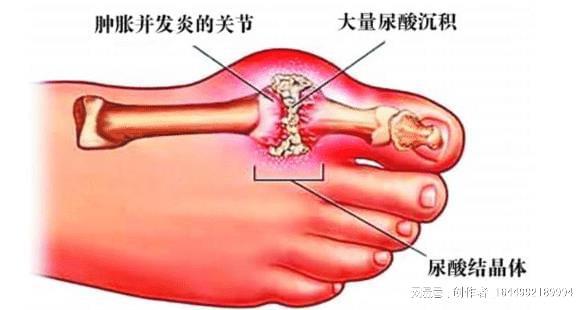 喝水促進(jìn)腎臟功能與新陳代謝平衡，關(guān)鍵所在