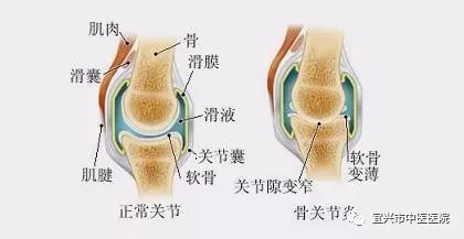 適量運(yùn)動對骨骼長期強(qiáng)度的積極影響